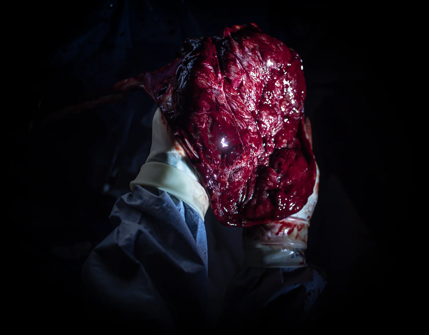 Placenta detail photograph