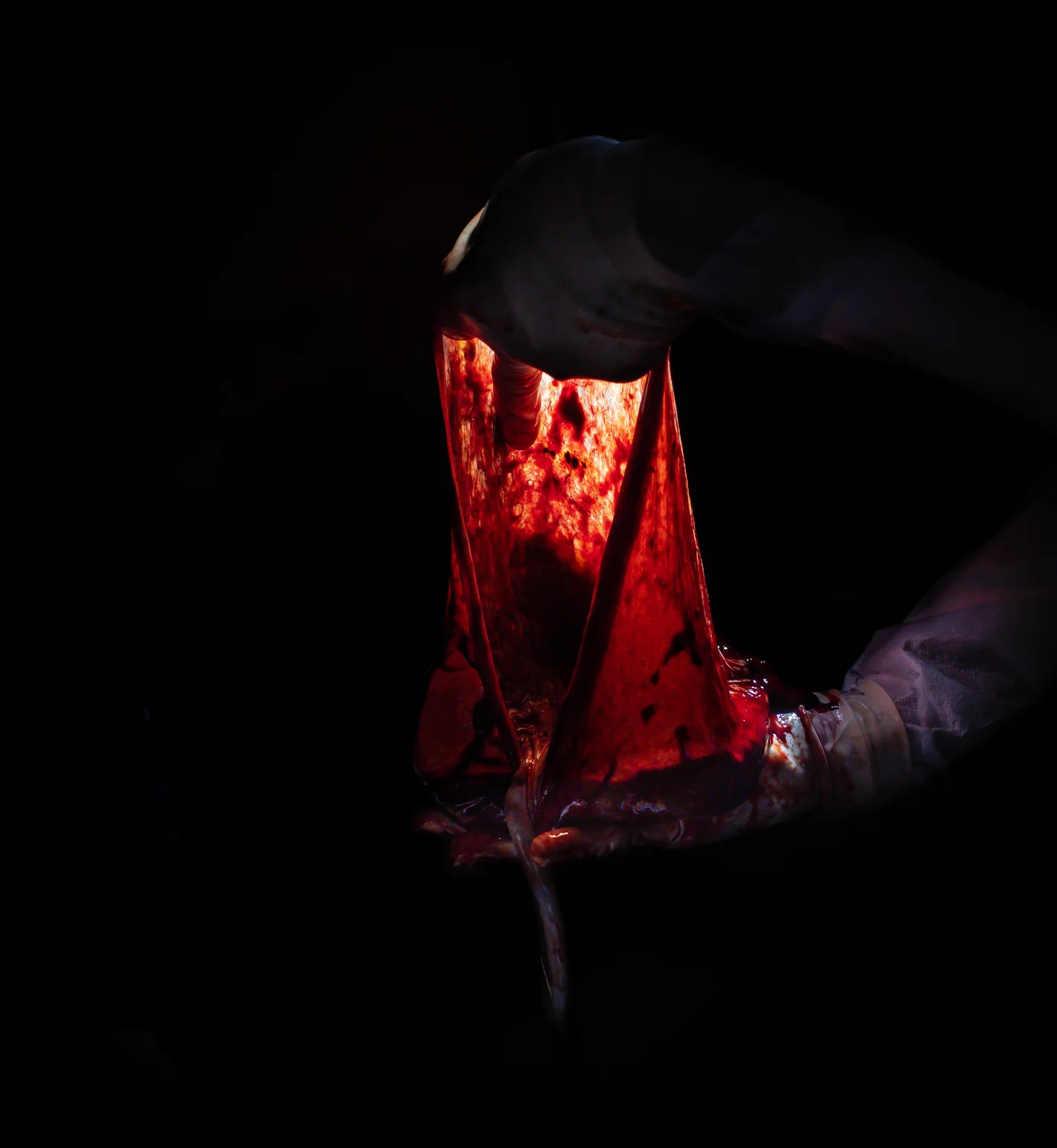 Documentary placenta and birth detail